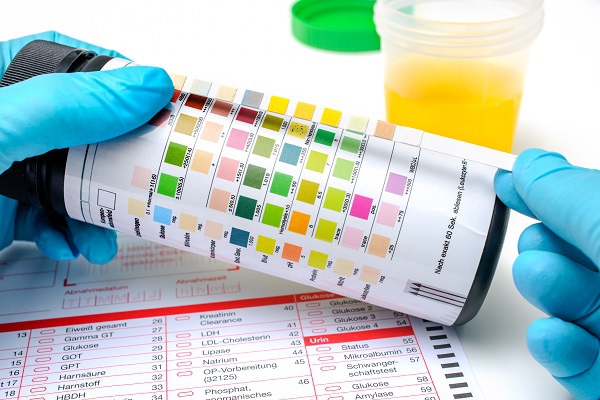 Drug Tests and How Long Drugs Stay in Your System